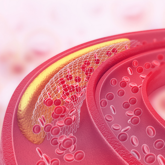 Treatment of Hypercholesterolemia - According to the Latest ESC/EAS Guidelines